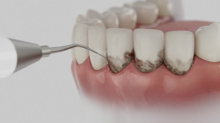 Trusted Root Canal Treatment service in Milton, DE - Dentist Open Now